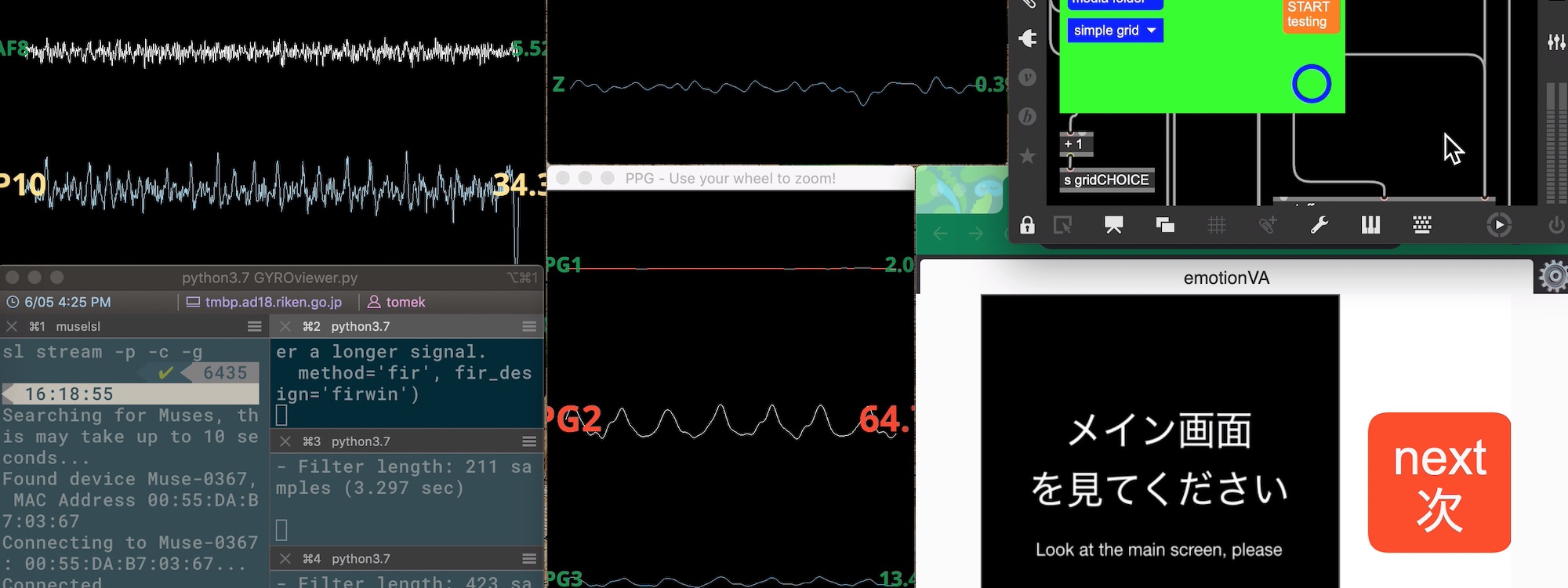 EEG analysis